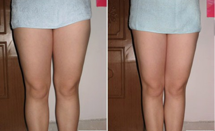 瘦大腿较有的方法是什么
